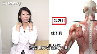 肩膀痠痛總是又按又搥　台大醫師2招教你放鬆「斜方肌」