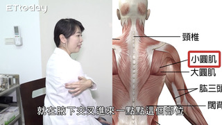 小圓肌拉筋超Easy　台大醫師讓你一次放鬆三塊肌肉