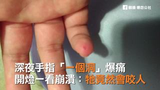 深夜手指「一個洞」爆痛　 開燈一看崩潰：牠竟然會咬人