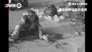 志工婦遭3狗狂咬耳朵差點掉　全身皮膚被掀開！爆血險死