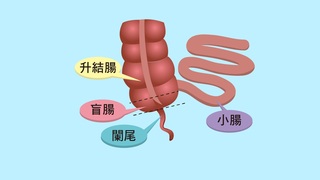 照護線上-闌尾發炎不能拖，以免變成要命腹膜炎！