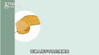 照護線上-常讓人措手不及的胰臟癌