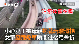 小心腿！被母親抱著玩溜滑梯　女童腳踩煞車瞬間往後弓骨折