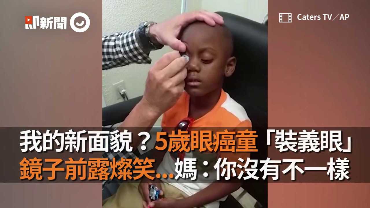 我的新面貌？5歲眼癌童「裝義眼」　鏡子前露燦笑...媽：你沒有不一樣 | 播吧BOBA | ETtoday新聞雲