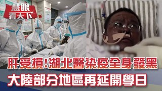 肝受損!湖北醫染疫全身發黑 疫情反覆!大陸部分地區再延開學日｜20200425慧眼看天下第95集 黃寶慧主持-透視兩岸-EP95精華