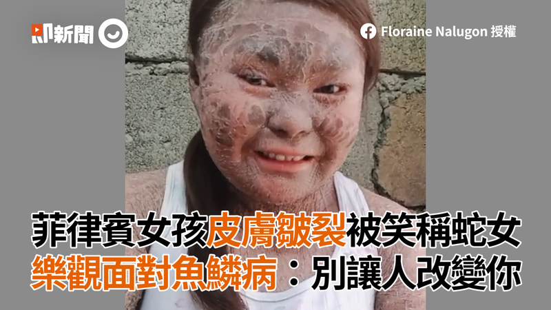 交往2年不敢素顏見男友 要一起出國了她超焦慮醫 是病 Ettoday健康雲 Ettoday新聞雲