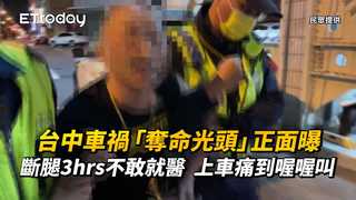 台中車禍「奪命光頭」正面曝！斷腿3hrs不敢就醫　上車痛到喔喔叫