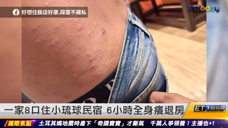 一家8口住小琉球民宿 6小時全身癢退房 ｜20230210 ET午間新聞