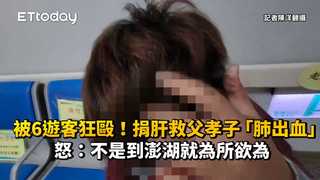 被6遊客狂毆！捐肝救父孝子「肺出血」怒：不是到澎湖就為所欲為