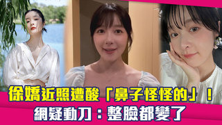 徐嬌近照遭酸「鼻子怪怪的」！　網疑動刀：整臉都變了
