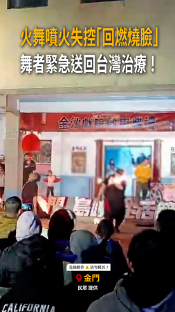 【金門火舞失控瞬間】舞者遭噴火燒臉　緊急送回台灣治療