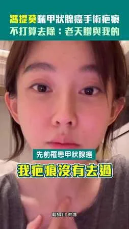 馮提莫曬甲狀腺癌手術疤痕　不打算去除：老天贈與我的