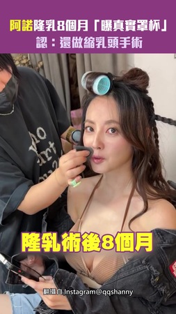 阿諾隆乳8個月「曝真實罩杯」　認：還做縮乳頭手術