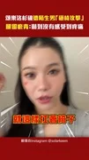 頌樂洛杉磯遭陌生男「砸椅攻擊」 腿留瘀青:嚇到沒有感受到疼痛