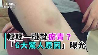 輕輕一碰就瘀青？　「6大驚人原因」曝光...你老了啦！