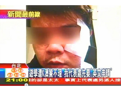 莫名被打到鼻青臉腫的吳姓遊學生。(圖／翻攝自TVBS新聞台)