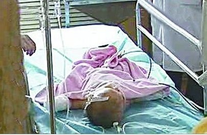 濟南8月大女嬰　雙手被姥姥剁了。(圖／陝西電視台)