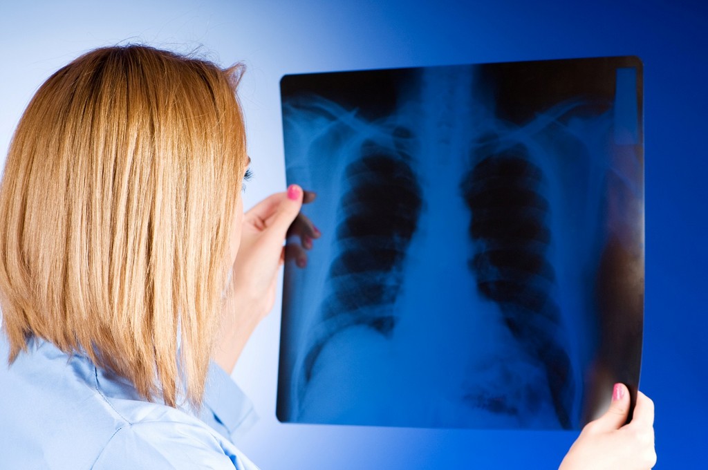 「肺癌」殺進癌症榜首！「7症狀」超容易被忽視　不抽菸也會得 | ETto
