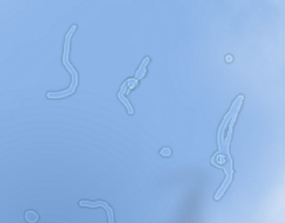 飛蚊症電腦模擬示意圖。（圖／翻攝自維基百科）