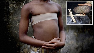 怕被強暴懷孕，非洲母親盛行將女兒乳房「熨爛燙平」