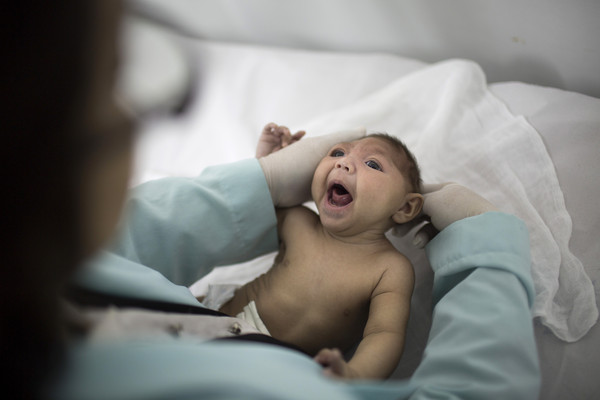 茲卡病毒能導致新生兒畸形出現小頭症。（圖／達志影像／美聯社）