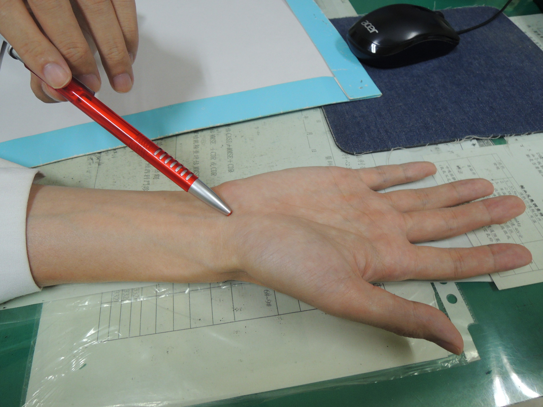 腕隧道症候群好發部位。（圖／彰化醫院提供）