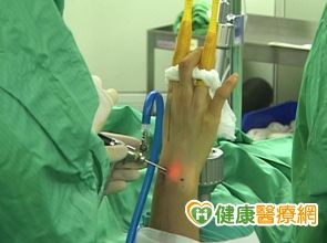 手腕部關節鏡修復縮短復原時間 Ettoday健康雲 Ettoday新聞雲