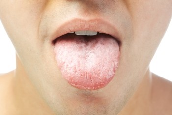 舌頭。（圖／達志／示意圖）