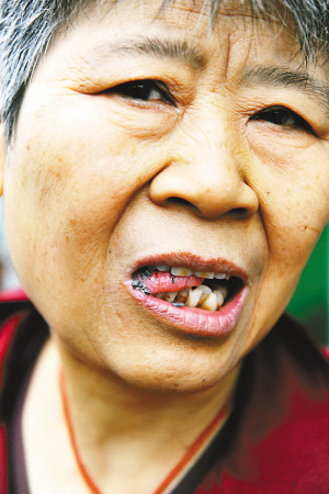 重庆62岁铁齿铜牙老太太 30秒咬碎石头吞下肚