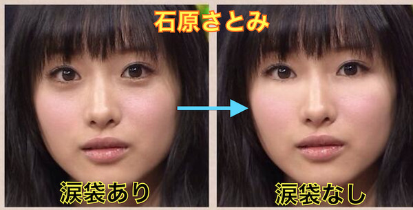 眼袋 臥蠶 傻傻分不清眼科醫師 美跟老的差別 Ettoday健康雲 Ettoday新聞雲