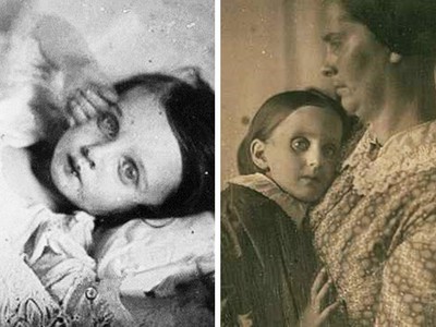 詭異歪頭眼皮撐開～19世紀父母爭拍「童屍照」假裝孩子沒死