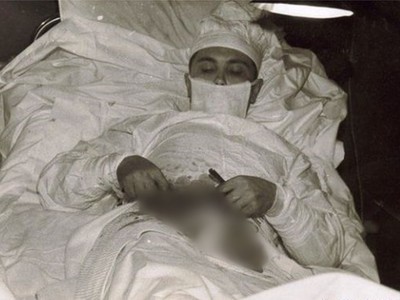 歷史最震撼照片：俄醫生沒麻醉開刀「切自己腹」，最後活了下來