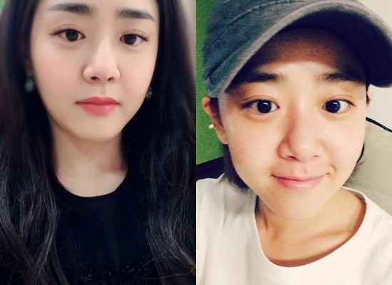 文瑾瑩準備4度動刀救命 醫師診斷 還有2次手術 Ettoday星光雲 Ettoday新聞雲