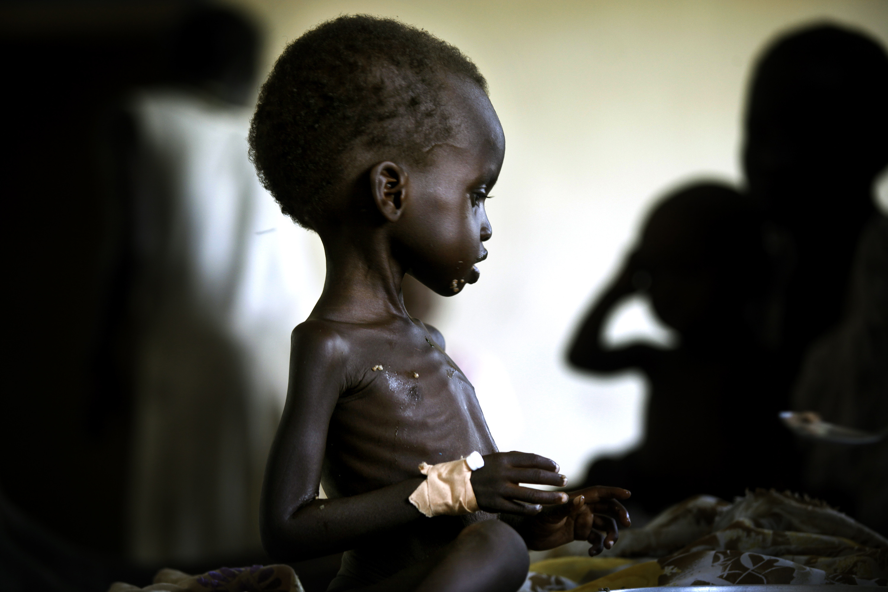 南蘇丹飢荒,south sudan（圖／達志影像／美聯社）
