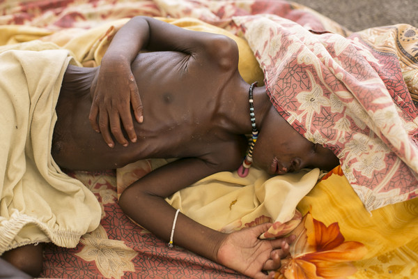 南蘇丹飢荒,south sudan（圖／達志影像／美聯社）