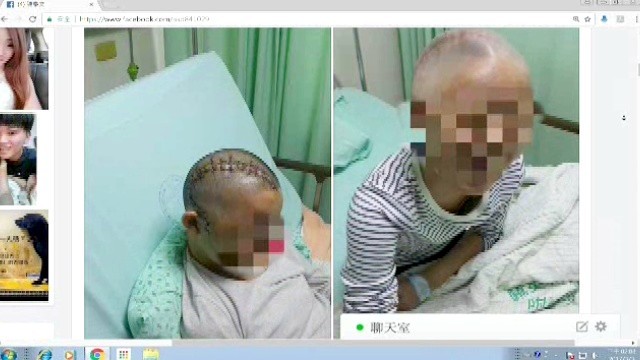 騎車違規挨撞 國中女 頭骨碎 半癱姊訴 駕駛要告她 Ettoday社會新聞 Ettoday新聞雲