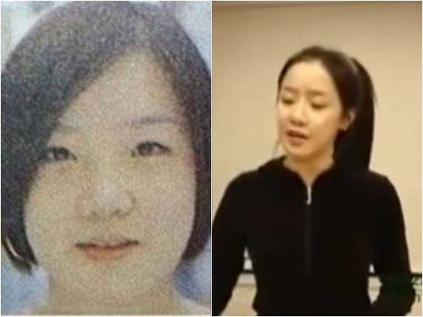 朴春2003年從美國回南韓參加甄選時，臉型是標準的韓國面孔，腮幫子圓鼓鼓的看起來很可愛。