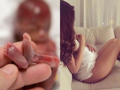 澳洲少女為「變緊」不怕傷身！懷孕狂抽菸、生早產寶寶
