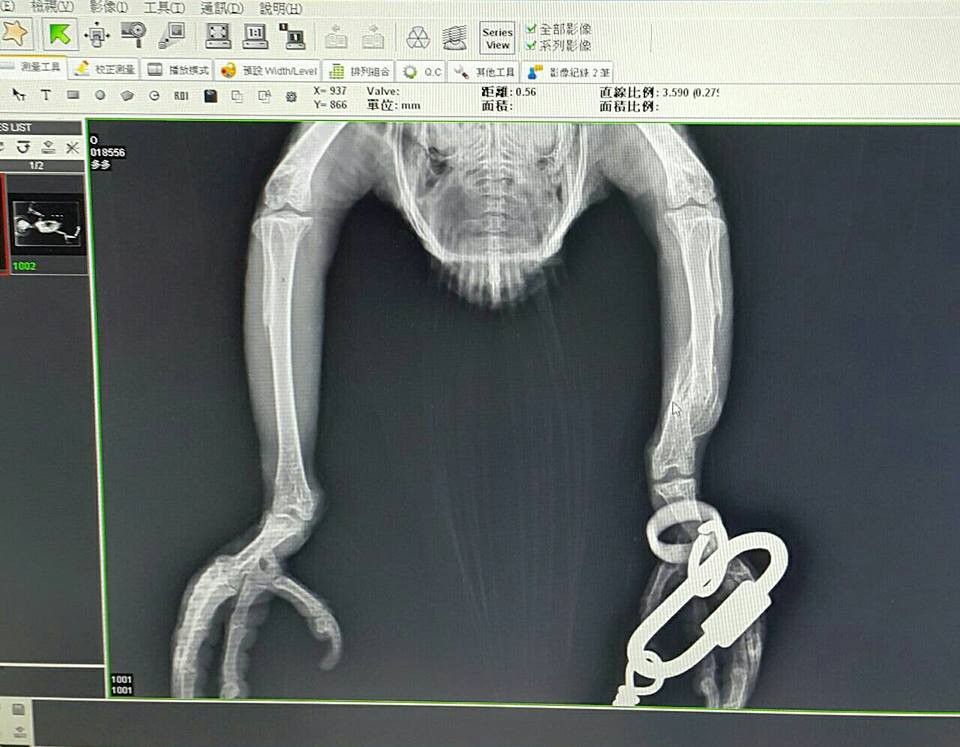 ▲鸚鵡被打到雙腿「骨折長歪」　她心痛買下給鳥寶滿滿的愛（圖／網友童翊華提供，下同）