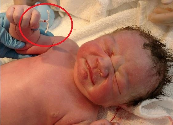 嬰兒手握避孕器的照片在網路上爆紅。（圖／取自IG／curlykittycrochet）