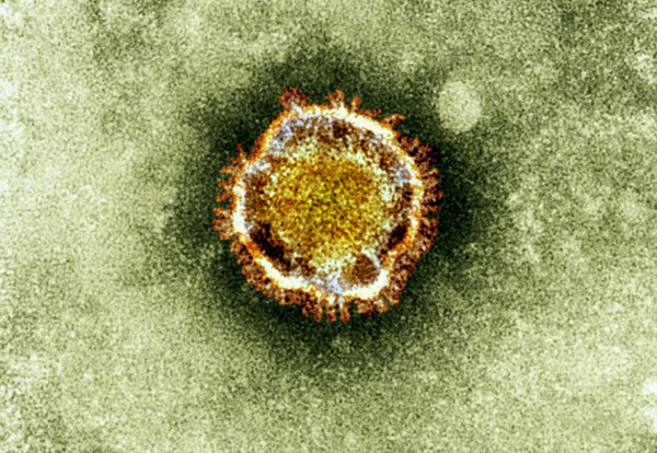 新型冠状病毒死亡照片图片
