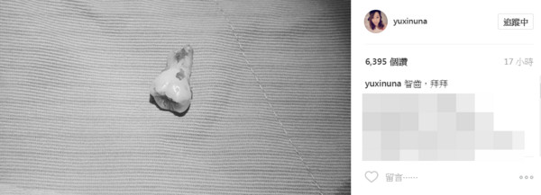 夏語心5月23日在Instagram曬出完整的智齒照，寫下：「智齒，拜拜。」