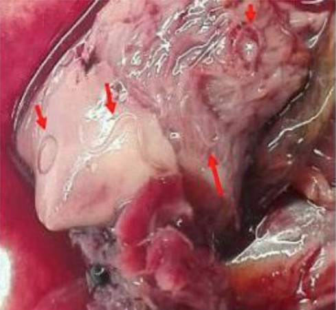 海獸胃線蟲幼蟲於鯖魚幽門盲腸端(pyloric caeca)。（圖／范家堃教授提供）