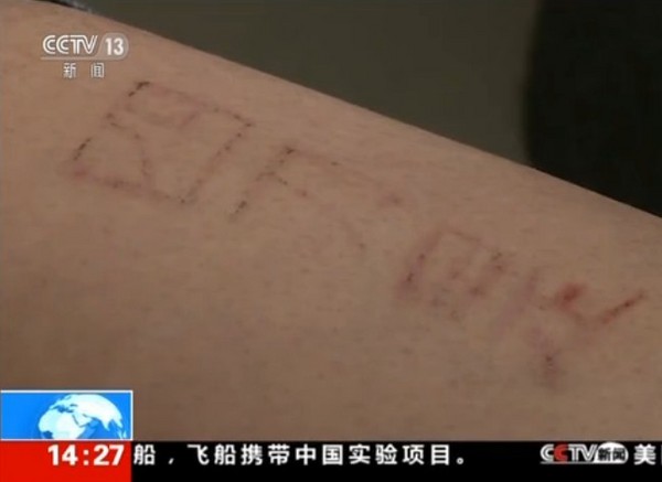 ▲江蘇19歲男子沉迷「藍鯨」死亡遊戲，一刀一刀在腿上刻字。（圖／翻攝自央視新聞網）