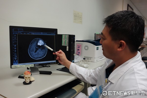 早期個性變化或記憶力不好 可能不只是單純失智(圖/大林慈濟醫院提供)