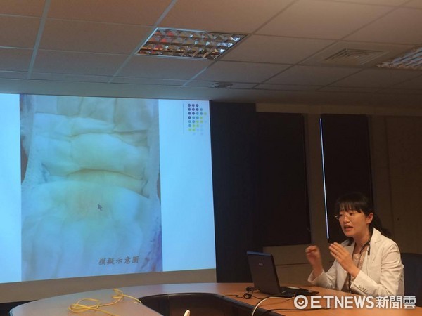 ▲寶寶尿布黃又臭,當心泌尿道感染在作怪。(圖/記者嚴云岑攝)