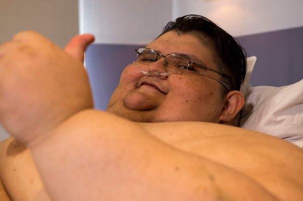 ▲▼世界上最胖的男子。（圖／CFP）
