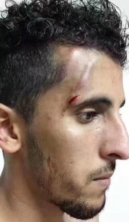 長沙阿拉伯籍足球員贏球被打。（圖／翻攝大陸網站）
