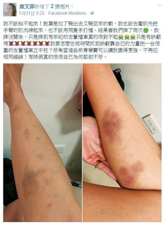 袁艾菲在臉書發文表示自己從打檔機車上摔下來2次，搞得全身都是傷。