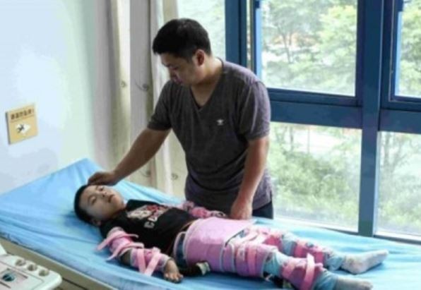 ▲▼陝西省神木市男童小旗旗被母親虐待，導致脊椎損傷、手腳嚴重痙攣變形。（圖／翻攝自《光華日報》）